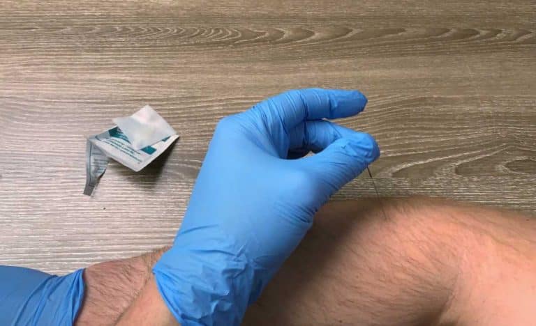 How To Reduce Soreness After Dry Needling Five Proven Tips Strength Resurgence