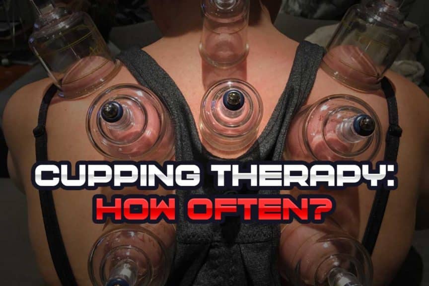 Cupping therapy blog title image