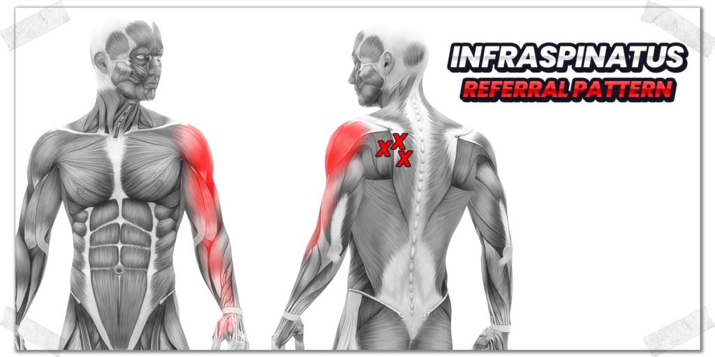 Elliptical upper top back pain
