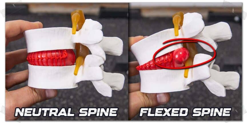 Low Back Rounding Lifter's Guide: Low Back Pain From Squatting | What To Know & Do ...