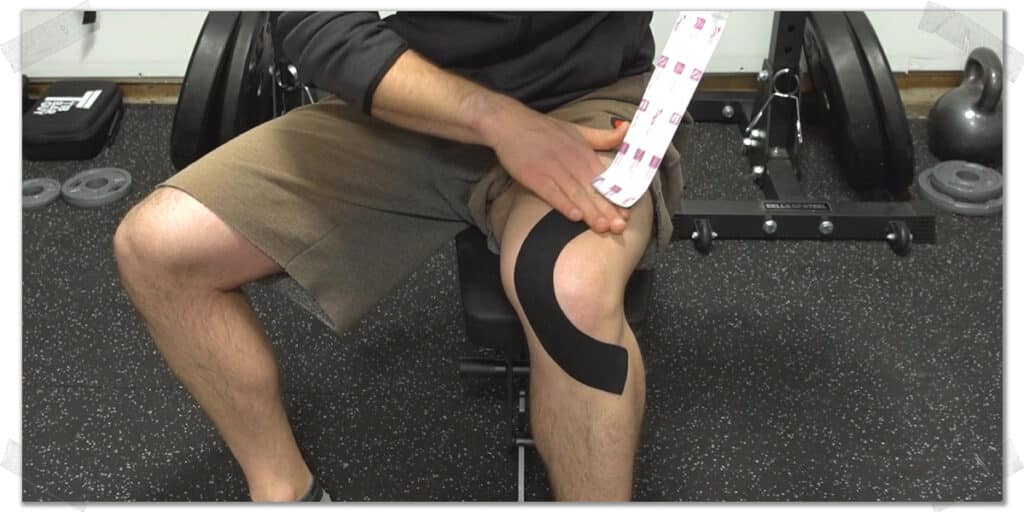 A) Method of applying ligament Kinesio tape around the knee B) Method